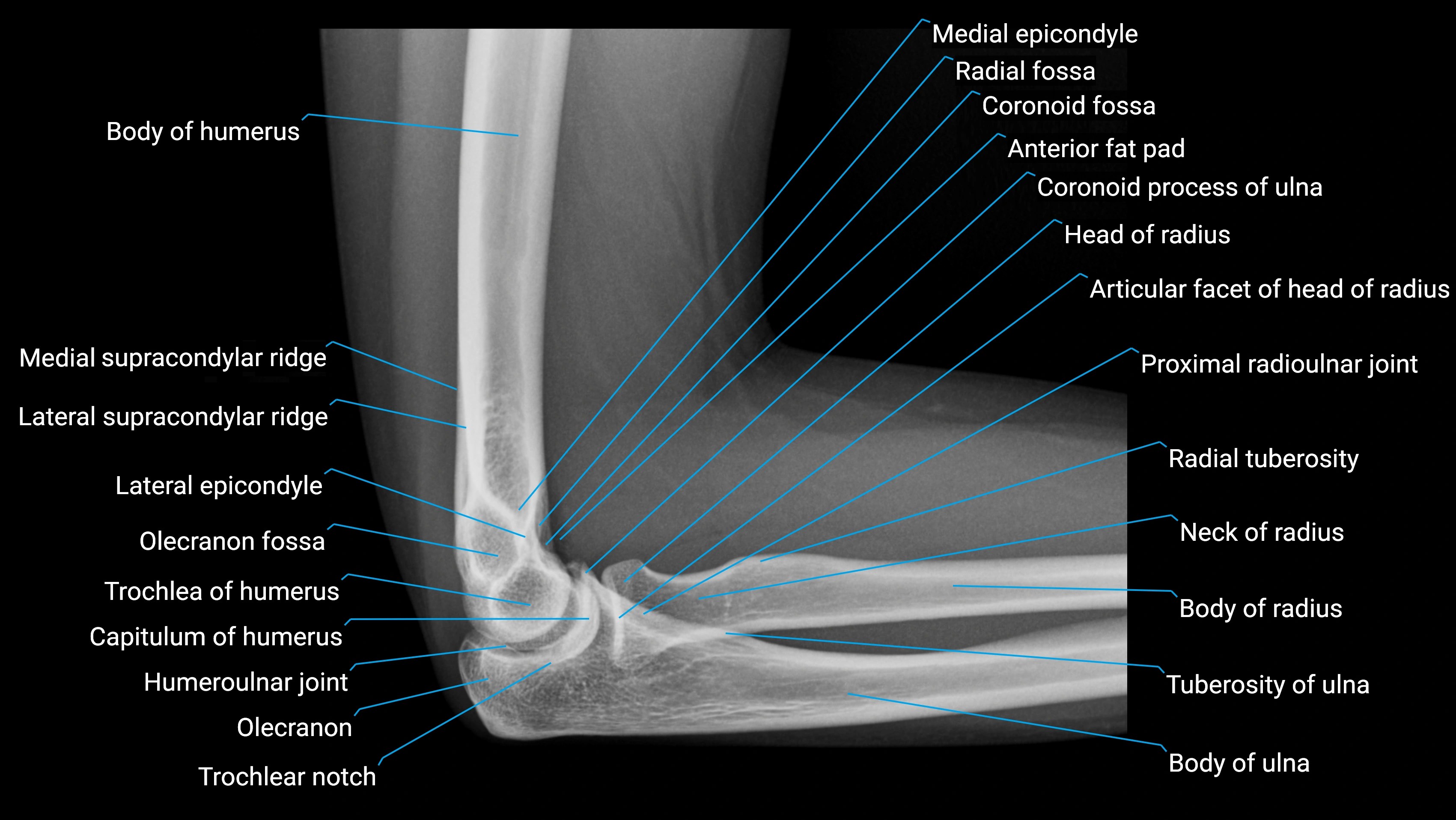 Elbow x-ray anatomy